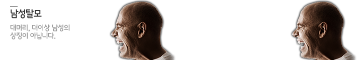 남성탈모